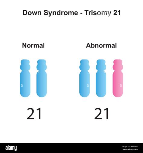 Chromosome 21